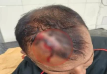 रायपुर में पत्रकार परिवार पर हमला, आरोपी मोहल्लेवासी के खिलाफ FIR दर्ज