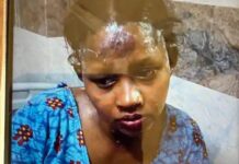 चरित्र शंका ने ली खौफनाक शक्ल: पति ने पत्नी को पेट्रोल डालकर जलाया, आरोपी गिरफ्तार