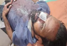 BREAKING: CM HOUSE के पास युवक पर चाकू से हमला, 15 हजार की लूट