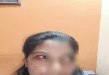 महिला पर घर में घुसकर हमला: मिर्च पाउडर फेंककर की मारपीट, जान से मारने की धमकी