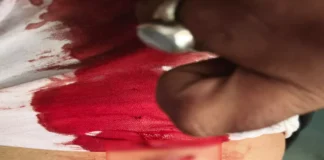 मंदिर परिसर में चाकूबाजी: शराब पीने से रोका तो युवक पर हमला, चार आरोपी फरार