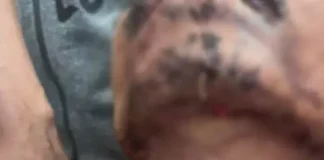 CG में सनसनी: पिता ने 6 साल की बेटी पर किया जानलेवा हमला, खुद को भी किया घायल