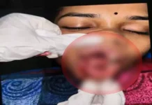 चलती कार पर पथराव, युवती गंभीर रूप से घायल — सिम्स रेफर