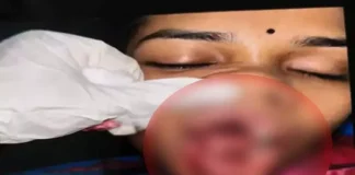 चलती कार पर पथराव, युवती गंभीर रूप से घायल — सिम्स रेफर