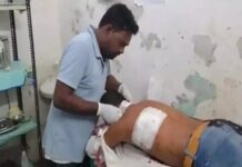 बदमाशों की बढ़ती गतिविधियों से लोगों में भय का माहौल: बाइक विवाद में युवक पर चाकू से हमला, इलाके में दहशत