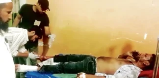 एसी रिपेयरिंग के दौरान जोरदार धमाका, कंप्रेशर फटने से दो सगे भाई जिंदगी और मौत के बीच