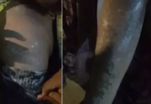 CG BREAKING: गैस सिलेंडर पाइप फटने से लगी आग, तीन महिलाएं समेत चार लोग झुलसे