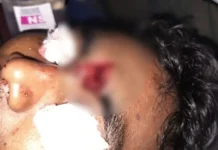 CG BREAKING: सड़क हादसे के बाद सक्ती में बवाल, प्रदर्शनकारियों ने पुलिस पर किया पथराव, आरक्षक गंभीर घायल