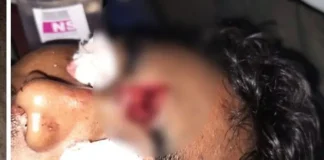 CG BREAKING: सड़क हादसे के बाद सक्ती में बवाल, प्रदर्शनकारियों ने पुलिस पर किया पथराव, आरक्षक गंभीर घायल