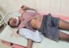 मेडिकल कॉलेज में हड़कंप, महिला वार्ड के बाथरूम की खिड़की से मरीज के पति ने लगाई छलांग