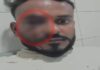 पुराने लेन-देन के विवाद ने लिया हिंसक रूप, युवक पर हमला, पुलिस जांच में जुटी