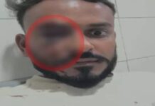 पुराने लेन-देन के विवाद ने लिया हिंसक रूप, युवक पर हमला, पुलिस जांच में जुटी