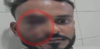 पुराने लेन-देन के विवाद ने लिया हिंसक रूप, युवक पर हमला, पुलिस जांच में जुटी