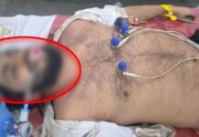बारिश बनी काल! कॉलेज छात्र की दर्दनाक मौत, डॉक्टर ने सड़क पर दिया CPR, फिर भी नहीं बच सकी जान
