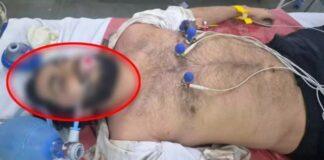 बारिश बनी काल! कॉलेज छात्र की दर्दनाक मौत, डॉक्टर ने सड़क पर दिया CPR, फिर भी नहीं बच सकी जान