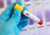जिला जेल में 4 बंदी HIV पॉजिटिव, स्वास्थ्य व्यवस्था पर उठे सवाल