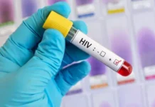 जिला जेल में 4 बंदी HIV पॉजिटिव, स्वास्थ्य व्यवस्था पर उठे सवाल