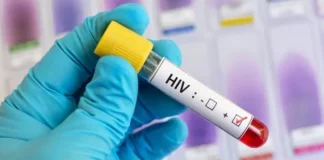 जिला जेल में 4 बंदी HIV पॉजिटिव, स्वास्थ्य व्यवस्था पर उठे सवाल