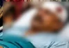शराब के नशे में बहू का बवाल, ससुर पर ईंट से किया हमला, मोहल्लेवासी भी बने निशाना