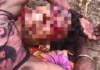 पहाड़ी पर घूमने गया युवक भालू के हमले का शिकार, गंभीर हालत में मेडिकल कॉलेज रेफर