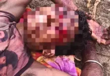 पहाड़ी पर घूमने गया युवक भालू के हमले का शिकार, गंभीर हालत में मेडिकल कॉलेज रेफर