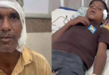 पागल कुत्ते का आतंक: 3 बच्चों समेत 6 लोगों को काटा, गांव में दहशत का माहौल