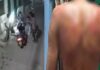 बहन की रक्षा करना पड़ा भारी, विरोध करने पर भाई को पीटा; CCTV में कैद हुई वारदात